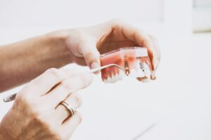 A person comparing a dental implant model and a set of dentures held in each hand.