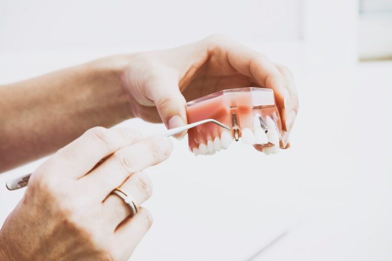 A person comparing a dental implant model and a set of dentures held in each hand.