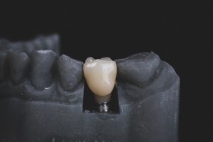 A close-up of a dental professional showing a patient a dental implant model in a consultation room.