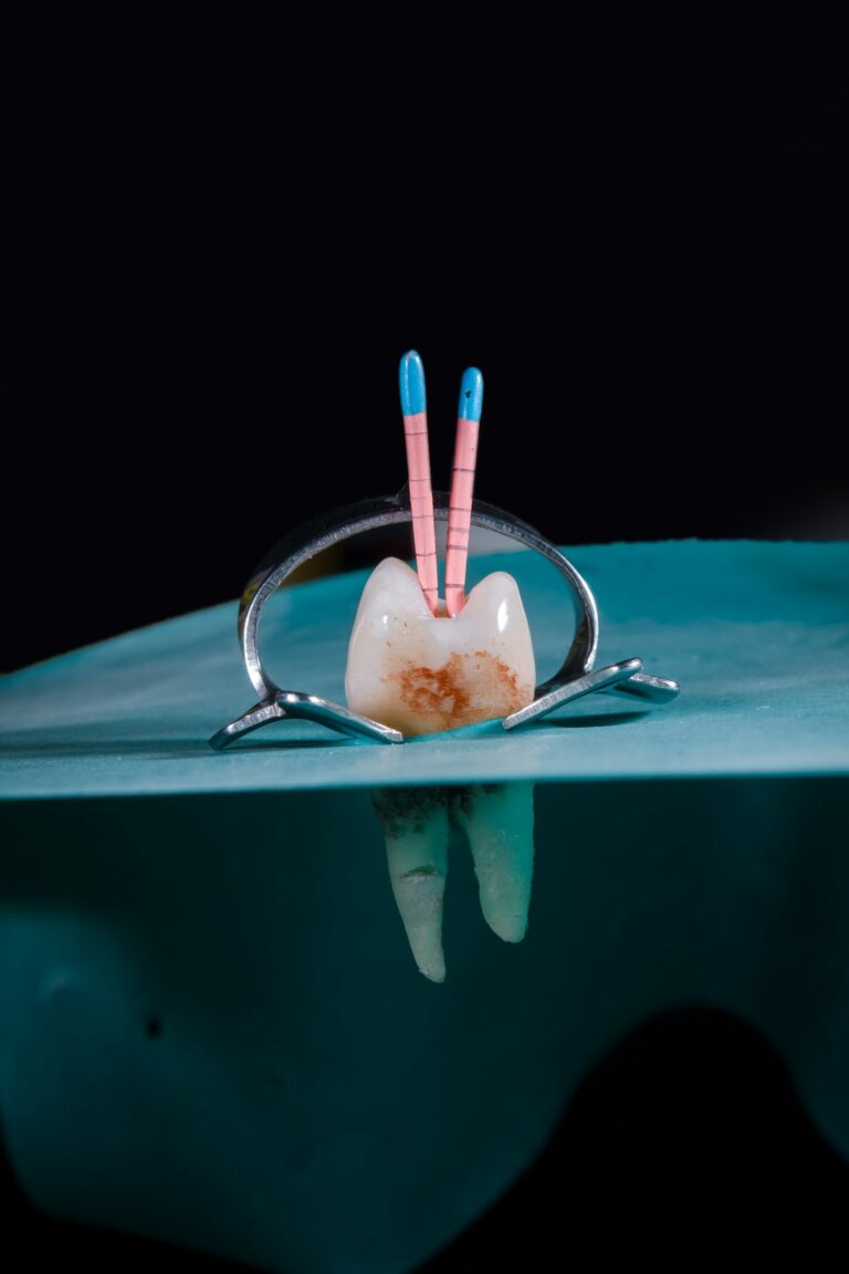 A dentist reviews a dental scan with an adult patient, showing a cross-section of the jaw and implant locations.