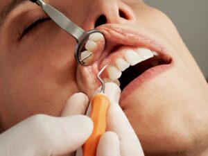 A person gently brushing their teeth and dental implants with a soft-bristled toothbrush in a home bathroom.